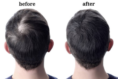 MINOXY PLUS hair spray 60ml | Minoxidil serum